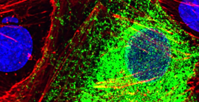Una inteligencia artificial de Stanford identifica células sanas y enfermas a partir de la actividad de sus genes