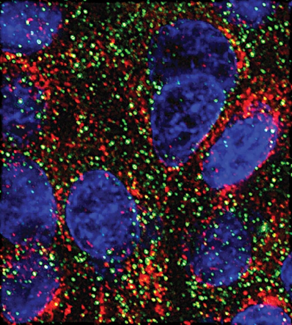 MicroARN frenan el crecimiento de células pancreáticas en laboratorio